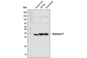 Arginase-1 (D4E3M) XP Rabbit mAb (HRP Conjugate)