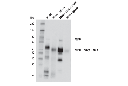 Myeloperoxidase Antibody