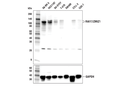 RAI17/ZMIZ1 (E2X3X) Rabbit mAb