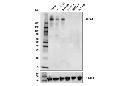 ABCA1 (E7X5G) Rabbit mAb