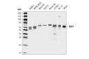 IL-2Rα/CD25 (E9W2J) XP Rabbit mAb